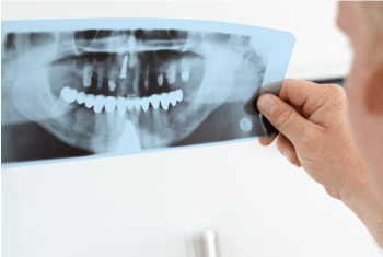 Dental-X-Ray